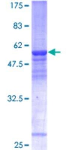 Novus Biologicals Recombinant Human SF3B5 GST (N-Term) Protein 25 &mu;g | Buy Online | Novus Biologicals&trade; | Fisher Scientific