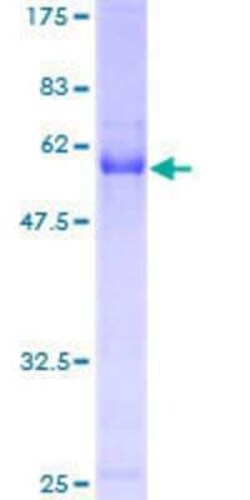 Novus Biologicals&trade;&nbsp;Recombinant Human CDCA3 GST (N-Term) Protein