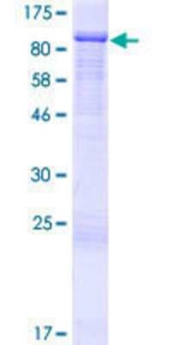 Novus Biologicals Recombinant Human ARHGAP24 GST (N-Term) Protein 2 &mu;g | Buy Online | Novus Biologicals&trade; | Fisher Scientific