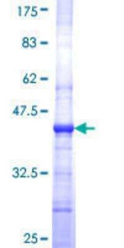 Novus Biologicals Recombinant Human PLVAP GST (N-Term) Protein 25 &mu;g | Buy Online | Novus Biologicals&trade; | Fisher Scientific