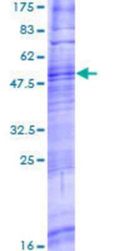 Novus Biologicals Recombinant Human TAAR8 GST (N-Term) Protein 2 &mu;g | Buy Online | Novus Biologicals&trade; | Fisher Scientific