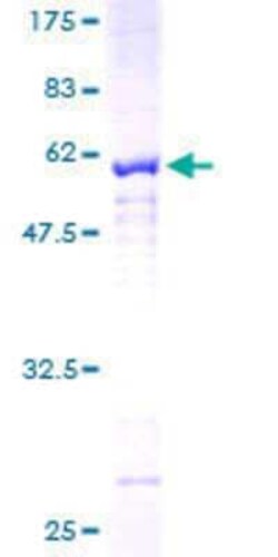 Novus Biologicals Recombinant Human AKR1CL2 GST (N-Term) Protein 10 &mu;g | Buy Online | Novus Biologicals&trade; | Fisher Scientific