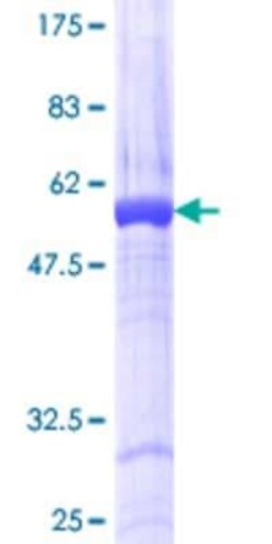 Novus Biologicals Recombinant Human NORE1 GST (N-Term) Protein 25 &mu;g | Buy Online | Novus Biologicals&trade; | Fisher Scientific