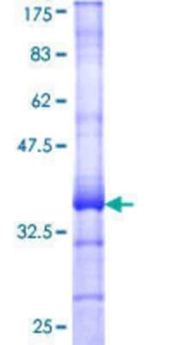 Novus Biologicals Recombinant Human RTP3 GST (N-Term) Protein 25 &mu;g | Buy Online | Novus Biologicals&trade; | Fisher Scientific
