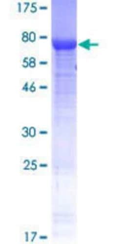 Novus Biologicals Recombinant Human RP3-402G11.5 GST (N-Term) Protein 25 &mu;g | Buy Online | Novus Biologicals&trade; | Fisher Scientific
