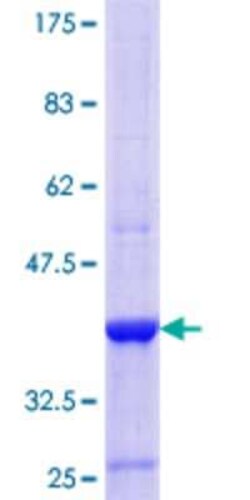 Novus Biologicals Recombinant Human TEKT1 GST (N-Term) Protein 10 &mu;g | Buy Online | Novus Biologicals&trade; | Fisher Scientific