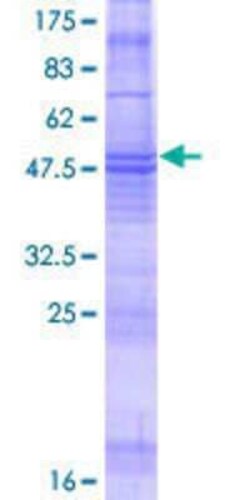 Novus Biologicals Recombinant Human MS4A8B GST (N-Term) Protein 25 &mu;g | Buy Online | Novus Biologicals&trade; | Fisher Scientific