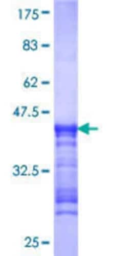 Novus Biologicals Recombinant Human RIOK1 GST (N-Term) Protein 10 &mu;g | Buy Online | Novus Biologicals&trade; | Fisher Scientific