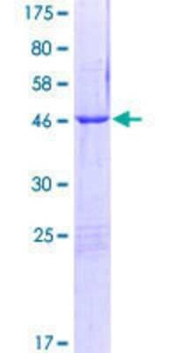 Novus Biologicals&trade;&nbsp;Recombinant Human Ropporin 1-like GST (N-Term) Protein
