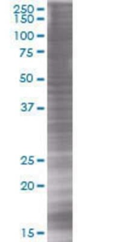 Novus Biologicals&trade;&nbsp;SNX25 293T Cell Transient Overexpression Lysate