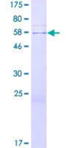 Novus Biologicals Recombinant Human TTC29 GST (N-Term) Protein 2 &mu;g | Buy Online | Novus Biologicals&trade; | Fisher Scientific