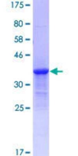 Novus Biologicals&trade;&nbsp;Recombinant Human KRTAP17-1 GST (N-Term) Protein