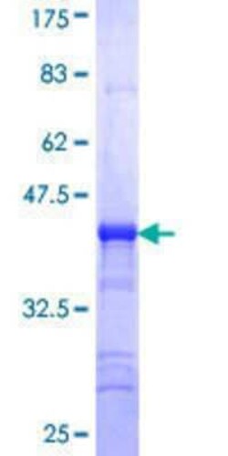 Novus Biologicals Recombinant Human STK40 GST (N-Term) Protein 25 &mu;g | Buy Online | Novus Biologicals&trade; | Fisher Scientific