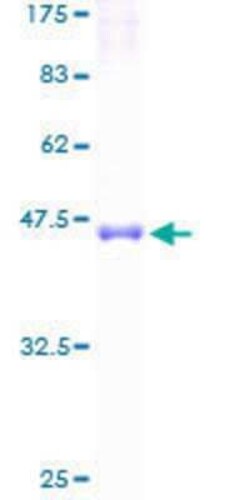 Novus Biologicals Recombinant Human TM2D1 GST (N-Term) Protein 25 &mu;g | Buy Online | Novus Biologicals&trade; | Fisher Scientific