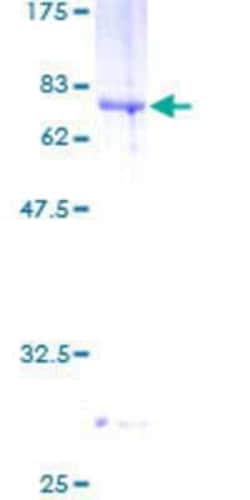 Novus Biologicals Recombinant Human B3GNT5 GST (N-Term) Protein 10 &mu;g | Buy Online | Novus Biologicals&trade; | Fisher Scientific