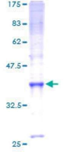 Novus Biologicals Recombinant Human SLC10A7 GST (N-Term) Protein 10 &mu;g | Buy Online | Novus Biologicals&trade; | Fisher Scientific