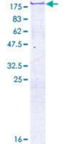 Novus Biologicals&trade;&nbsp;Recombinant Human FSCB GST (N-Term) Protein