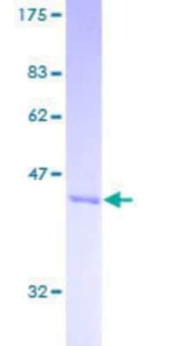 Novus Biologicals Recombinant Human ARL6 GST (N-Term) Protein 2 &mu;g | Buy Online | Novus Biologicals&trade; | Fisher Scientific
