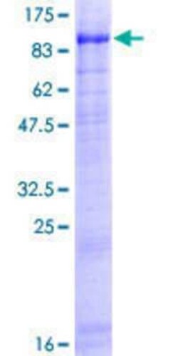 Novus Biologicals Recombinant Human USP44 GST (N-Term) Protein 25 &mu;g | Buy Online | Novus Biologicals&trade; | Fisher Scientific
