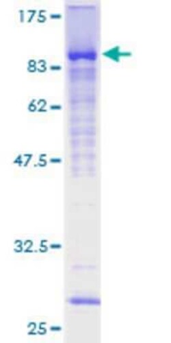 Novus Biologicals&trade;&nbsp;Recombinant Human ZNF394 GST (N-Term) Protein