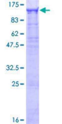 Novus Biologicals&trade;&nbsp;Recombinant Human WDR75 GST (N-Term) Protein