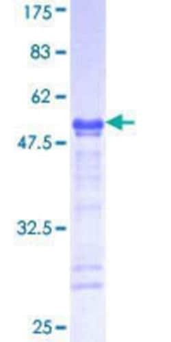 Novus Biologicals Recombinant Human USP42 GST (N-Term) Protein 25 &mu;g | Buy Online | Novus Biologicals&trade; | Fisher Scientific