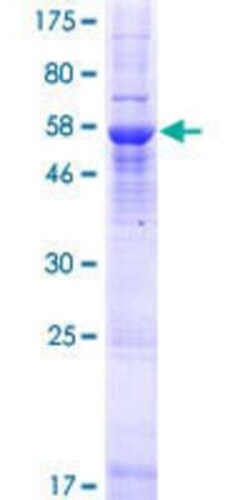 Novus Biologicals&trade;&nbsp;Recombinant Human TOMM40L GST (N-Term) Protein