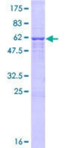 Novus Biologicals Recombinant Human UTP15 GST (N-Term) Protein 25 &mu;g | Buy Online | Novus Biologicals&trade; | Fisher Scientific