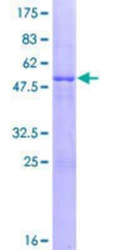 Novus Biologicals&trade;&nbsp;Recombinant Human KIAA1109/FSA GST (N-Term) Protein