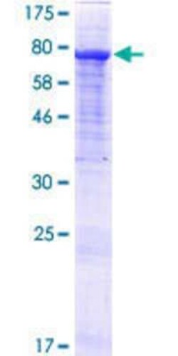 Novus Biologicals&trade;&nbsp;Recombinant Human GTF2IRD2 GST (N-Term) Protein