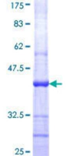 Novus Biologicals Recombinant Human POLR1B GST (N-Term) Protein 25 &mu;g | Buy Online | Novus Biologicals&trade; | Fisher Scientific