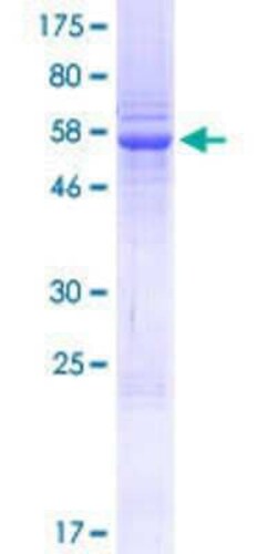Novus Biologicals Recombinant Human SETD3 GST (N-Term) Protein 10 &mu;g | Buy Online | Novus Biologicals&trade; | Fisher Scientific