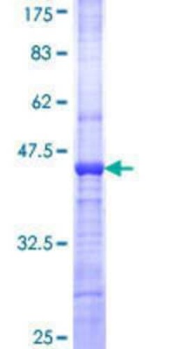 Novus Biologicals Recombinant Human POMK/SGK196 GST (N-Term) Protein 10 &mu;g | Buy Online | Novus Biologicals&trade; | Fisher Scientific