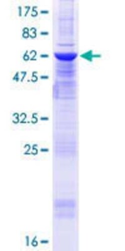 Novus Biologicals Recombinant Human ZMYND12 GST (N-Term) Protein 25 &mu;g | Buy Online | Novus Biologicals&trade; | Fisher Scientific