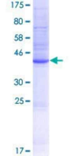 Novus Biologicals Recombinant Human TMEM191A GST (N-Term) Protein 25 &mu;g | Buy Online | Novus Biologicals&trade; | Fisher Scientific