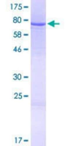 Novus Biologicals Recombinant Human IQCG GST (N-Term) Protein 10 &mu;g | Buy Online | Novus Biologicals&trade; | Fisher Scientific