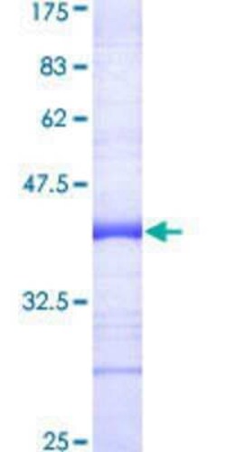 Novus Biologicals&trade;&nbsp;Recombinant Human TRAF7 GST (N-Term) Protein