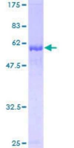 Novus Biologicals Recombinant Human EI2BL GST (N-Term) Protein 25 &mu;g | Buy Online | Novus Biologicals&trade; | Fisher Scientific