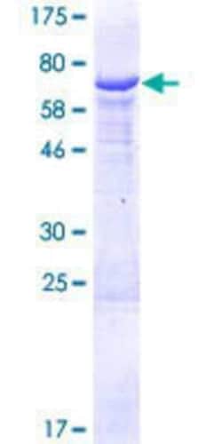 Novus Biologicals Recombinant Human HSDL2 GST (N-Term) Protein 10 &mu;g | Buy Online | Novus Biologicals&trade; | Fisher Scientific