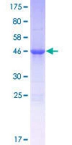 Novus Biologicals&trade;&nbsp;Recombinant Human ALKBH7 GST (N-Term) Protein