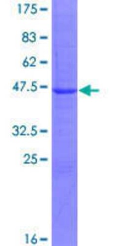 Novus Biologicals Recombinant Human bcl10-interacting CARD protein GST (N-Term) Protein 25 &mu;g | Buy Online | Novus Biologicals&trade; | Fisher Scientific