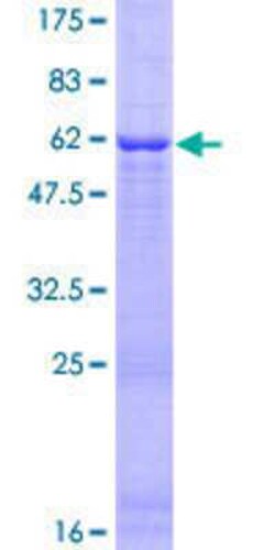 Novus Biologicals&trade;&nbsp;Recombinant Human Morg1 GST (N-Term) Protein