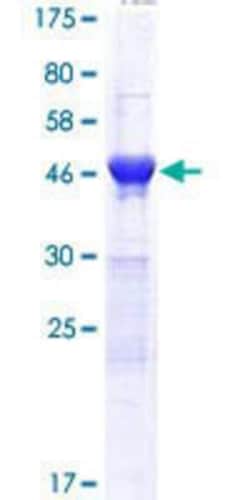 Novus Biologicals Recombinant Human DDI2 GST (N-Term) Protein 10 &mu;g | Buy Online | Novus Biologicals&trade; | Fisher Scientific
