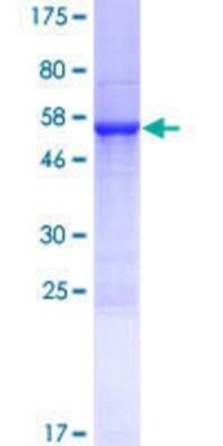 Novus Biologicals&trade;&nbsp;Recombinant Human CHCHD6 GST (N-Term) Protein