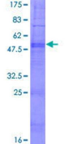 Novus Biologicals Recombinant Human PDCD2L GST (N-Term) Protein 25 &mu;g | Buy Online | Novus Biologicals&trade; | Fisher Scientific