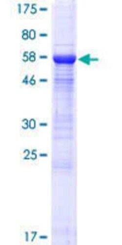 Novus Biologicals&trade;&nbsp;Recombinant Human BRMS1L GST (N-Term) Protein