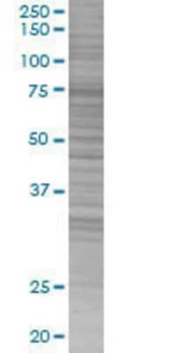 Novus Biologicals&trade;&nbsp;DYDC2 293T Cell Transient Overexpression Lysate