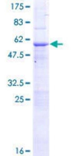 Novus Biologicals Recombinant Human PCGF5 GST (N-Term) Protein 10 &mu;g | Buy Online | Novus Biologicals&trade; | Fisher Scientific