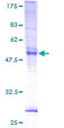 Novus Biologicals Recombinant Human TMEM101 GST (N-Term) Protein 25 &mu;g | Buy Online | Novus Biologicals&trade; | Fisher Scientific