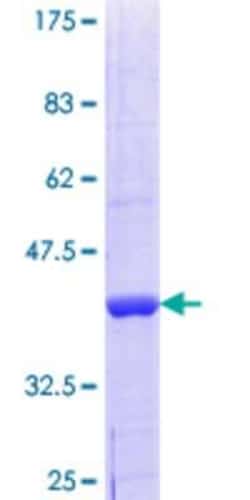 Novus Biologicals Recombinant Human GFM2 GST (N-Term) Protein 10 &mu;g | Buy Online | Novus Biologicals&trade; | Fisher Scientific